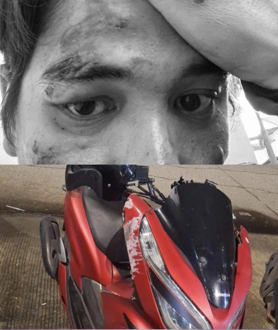 Korban Kecelakaan di Kota Tangerang Tak Akan Dilayani Rumah Sakit Walau Punya BPJS