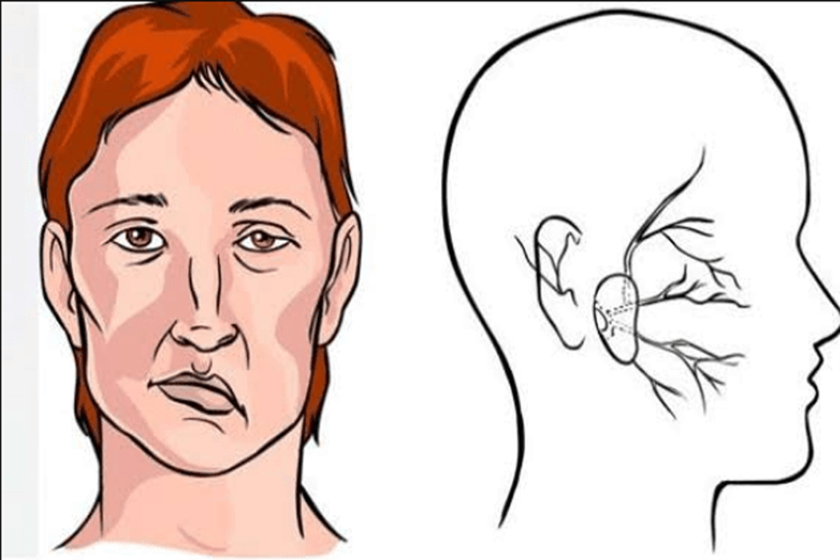 JANGAN ANGGAP SEPELE! 5 Kebiasaan 'Remaja' Ini Ternyata Bom Waktu Stroke di Usia 20-an